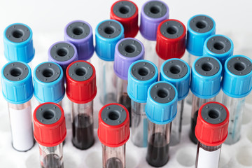 Coloured sample tubes